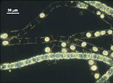 7 - Filamenti in fase di zoosporogenesi